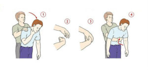 Šta raditi ako se zagrcnete, a pored vas nikog nema