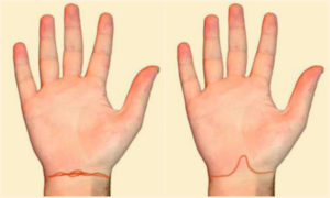 Šta označavaju linije na ručnom zglobu