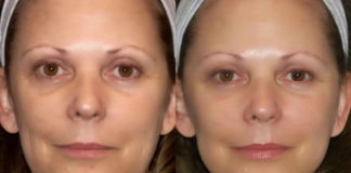 Zogan masaža. Fantastična podmlađujuća masaža lica.