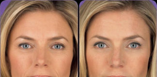 Efikasna domaća maska za zatezanje lica. Prirodni botoks!