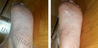 Efekat glatkih i nežnih stopala. Kako očistiti pete sa sodom bikarbonom.