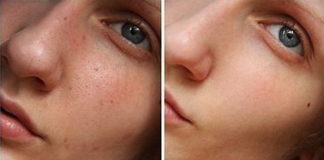 Odlično čišćenje lica kod kuće. Provereno!