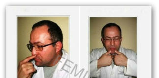 5 tačaka za masažu lica koje treba da znate