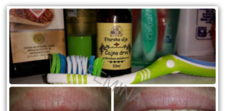 Izbeljujemo zube za 1-2 nijanse uz pomoć ulja čajnog drveta