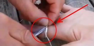 Šta raditi ako se prsten zaglavio na prstu