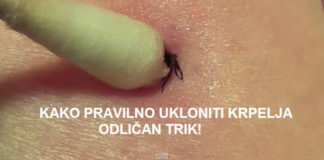 Kako izvaditi krpelja