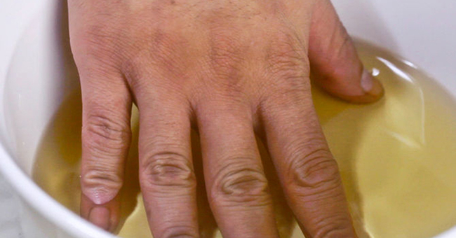 Jabukovo sirće - provereno oružje u borbi protiv artritisa i bolova u zglobovima.