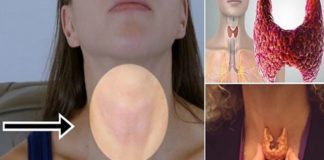 Kako proveriti štitnu žlezdu: biće potrebna čaša vode i ogledalo