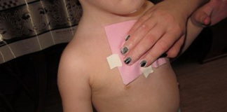 Medeni oblog – leči jak kašalj za jedno veče!