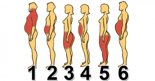 6 tipova gojaznosti