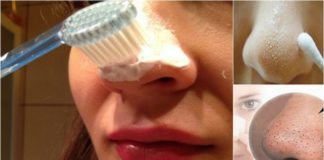 Kako ukoloniti mitisere na licu uz pomoć četkice za zube