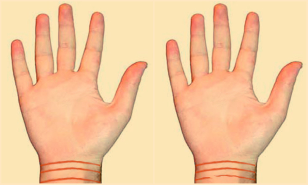 Šta označavaju linije na ručnom zglobu