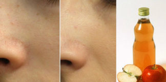 Jabukovo sirće za lice