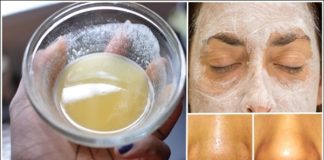 Odlična maska za masnu kožu lica