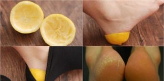 Kako izlečiti grube ispucale pete. Efikasno, a veoma jednostavno!