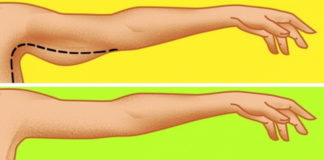 Kako ukloniti salo sa ruku