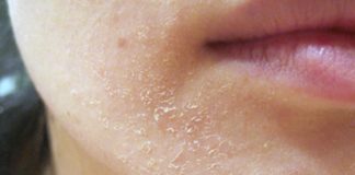 Kada organizam traži pomoć: 10 važnih signala