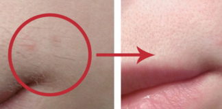 Hidrogen protiv nepoželjnih dlačica na licu. Efikasno!