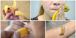 Iznenađujuća korist kore od banane.