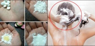 Aspirin za kosu: povratite sjaj i volumen beživotnoj masnoj kosi, i uklonite perut.