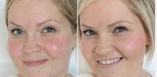 Kako očistiti i suziti pore na licu u kućnim uslovima