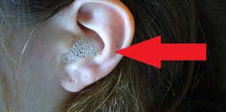 Kako isprati zapušene uši. Savet otolaringologa.