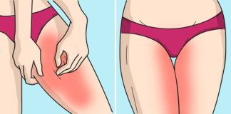 Ovog leta zaboravite na ojede između nogu