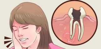 Domaće sredstvo protiv zubobolje