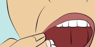 Boli zub. Prirodni lekovi protiv zubobolje.