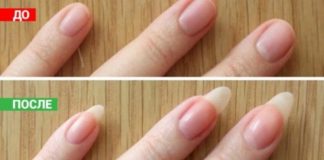 Samo tri sastojka vratiće tvojim noktima lepotu i zdravlje.