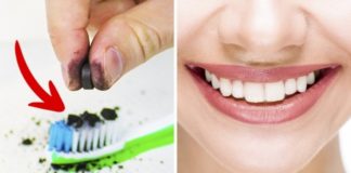 5 trikova za izbeljivanje zuba u kućnim uslovima