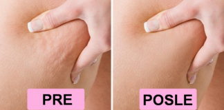 Ovo efikasno sredstvo za lepotu kose i kože može se naći u svakom domu