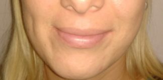 Kako napraviti rupice na obrazima u kućnim uslovima