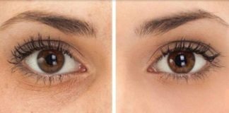 Pet načina da se brzo rešite podočnjaka