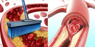 10 namirnica koje će bez upotrebe lekova, očistiti vaše arterije