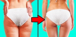 Plan kojim ćete ukloniti 80% celulita za mesec dana