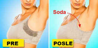 7 proverenih načina da se rešite prekomernog znojenja