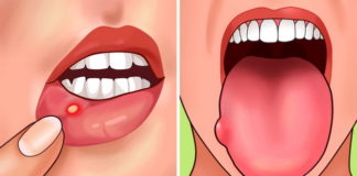 7 znakova da je vašem organizmu potrebno više folne kiseline