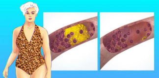 Šta se dešava s organizmom ako počnete da jedete heljdu triput nedeljno?