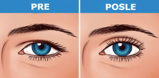 6 jednostavnih pokreta za masažu glave, koji će vam pomoći da uklonite bore