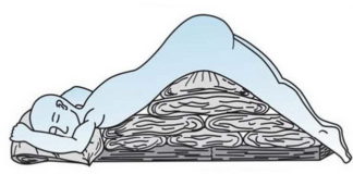 Posturalna drenaža: Tehnika za izbacivanje sekreta iz pluća