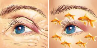 Riblje ulje: Najbolje sredstvo protiv bora