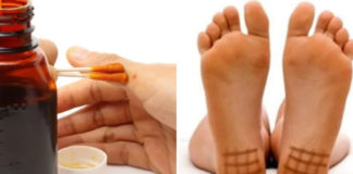 Jodna mreža: kako se pravi i čemu služi